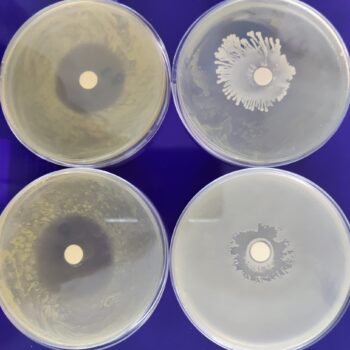 Halo de inhibición producidopor el antibiótico (izquierda) y el producido por la bacteria encontrada.